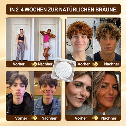 Offizieller Shop | ☀️☀️ Hiskin® Mikronadel-Pflaster für sonnenlose Bräune (Nur eine Anwendung täglich) Schon nach 7 Tagen strahlender bronzener Teint sichtbar