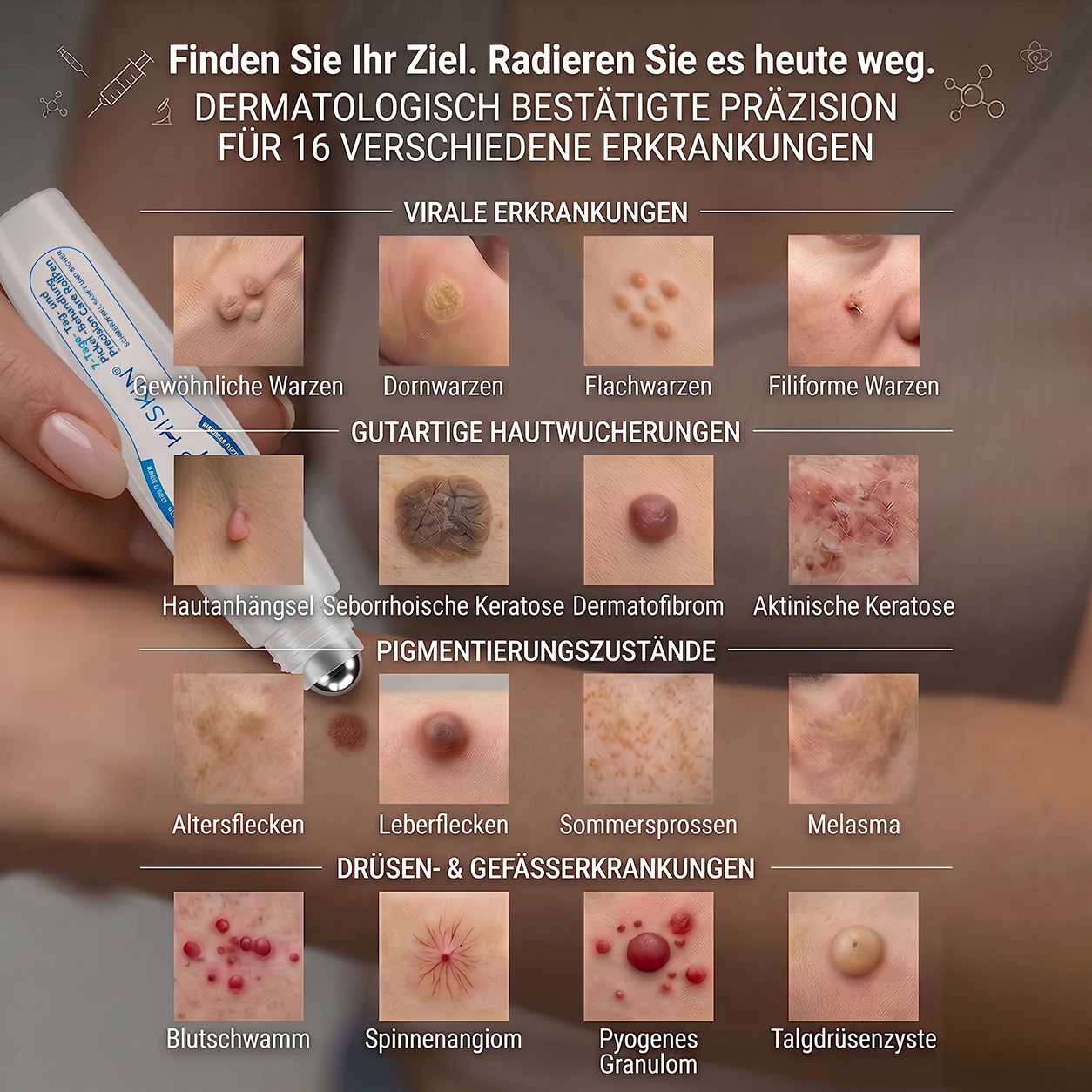 ⭐𝐇𝐈𝐒𝐊𝐈𝐍®👩‍⚕️⭐ 7-Tage-Hautmakel- & Hautanhängsel-Entferner Schmerzfreier Rollerball-Stift zur schonenden Entfernung von Hautanhängseln und Hautflecken – narbenfrei