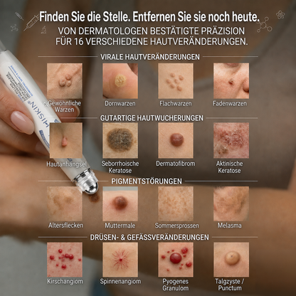 HISKIN®👩‍⚕️ 7-Tage-Hautmakel- & Hautanhängsel-Entferner Schmerzfreier Rollerball-Stift zur schonenden Entfernung von Hautanhängseln und Hautflecken – narbenfrei